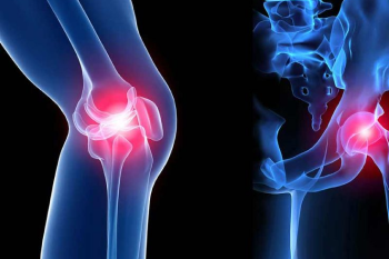Orthopaedics
